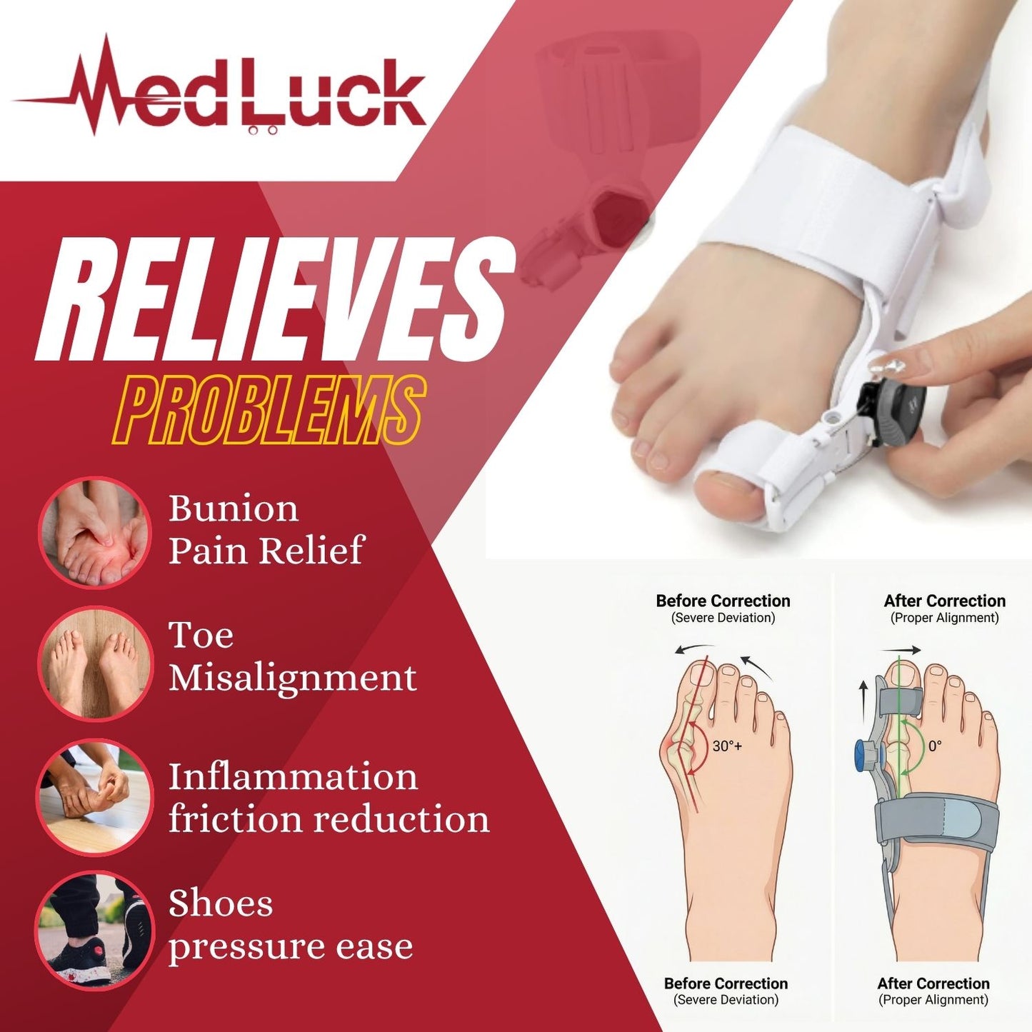 Medluck' Bunion Corrector Kit with Toe Separator for Bunion Relief, Day Night Support Orthopedic Bunion Toe Straightener,